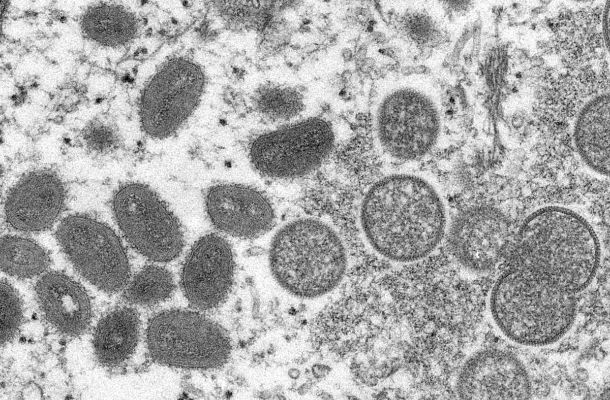 Affenpocken werden von winzig kleinen Viren ausgelöst. Foto: dpa/Cynthia S. Goldsmith