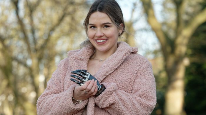 Wahl zur „Miss Germany“: Studentin mit Armprothese will Schönheitskönigin werden