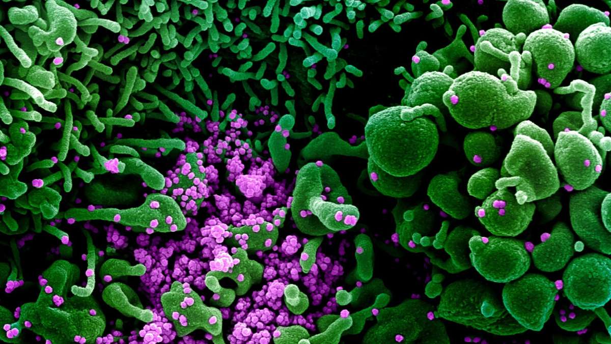 Bakterien, Viren und Laborunfälle: Riskante Forschung mit gefährlichen Erregern