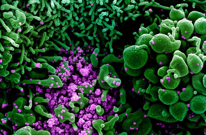 Bakterien, Viren und Laborunfälle: Riskante Forschung mit gefährlichen Erregern
