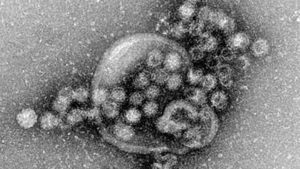Frage des Tages: Die Sache mit dem Noro-Virus